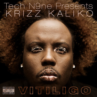 Krizz Kaliko - Vitiligo album cover